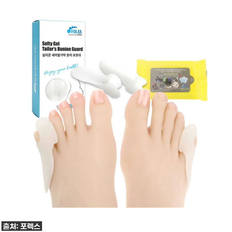 새끼발가락 통증 이젠 안녕! 소건막류 관련 이미지 1