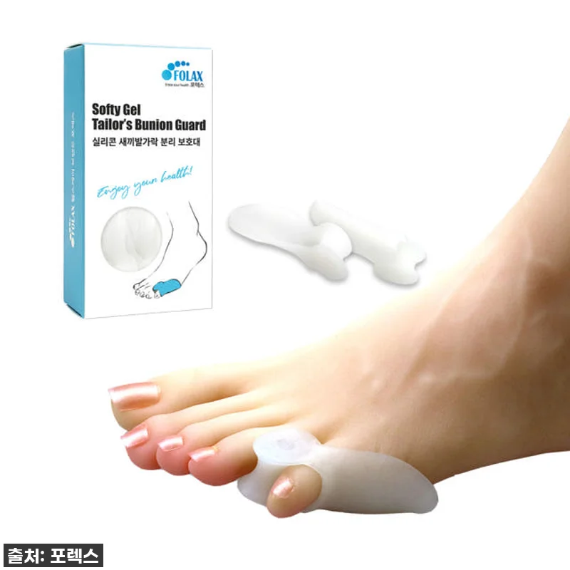 새끼발가락 통증 이젠 안녕! 소건막류 관련 이미지 2
