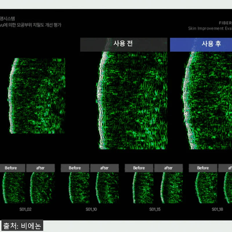비에논 파이버 앰플, 눈가와 모공 탄 관련 이미지 3