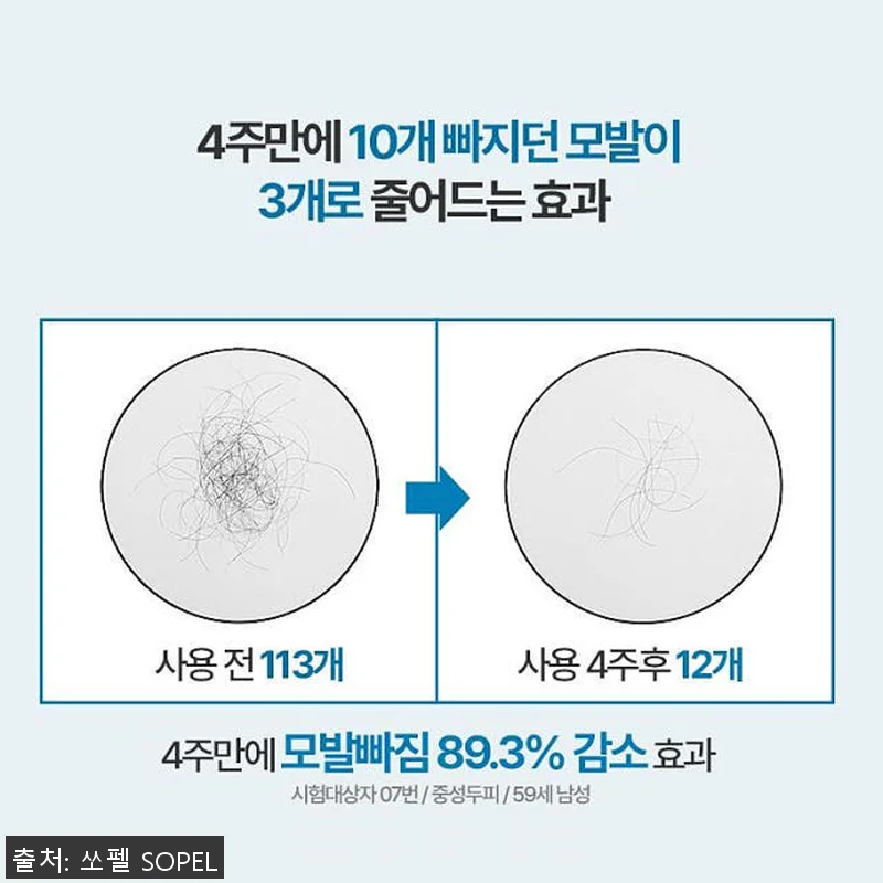 쏘펠 블로커12 남성 탈모완화샴푸 사 관련 이미지 6