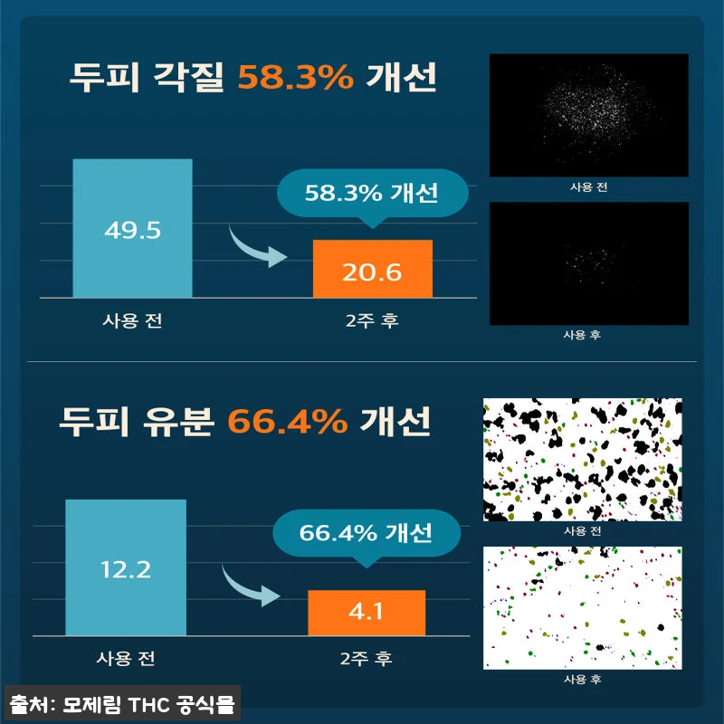 모제림 엘릭서 샴푸 300ml 사용후 관련 이미지 6